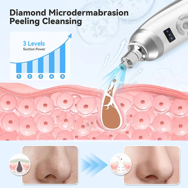Diamond MicrodermabrasionBlackhead Removal Professional Facial Skin Care