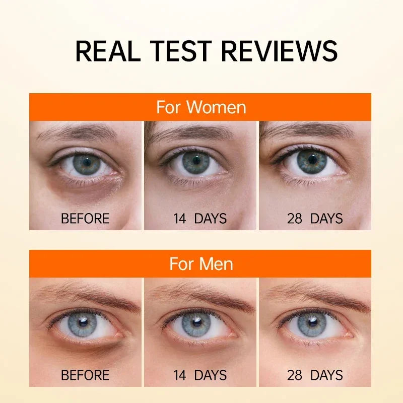 Vitamin C Eye Cream Anti Dark Circle - Free Shipping